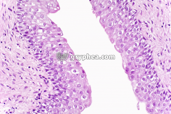 Epithélium vésical (vessie) x200 - gryphea.org